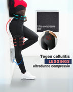 High-Waisted Compression Leggings for Women – Enhanced Support